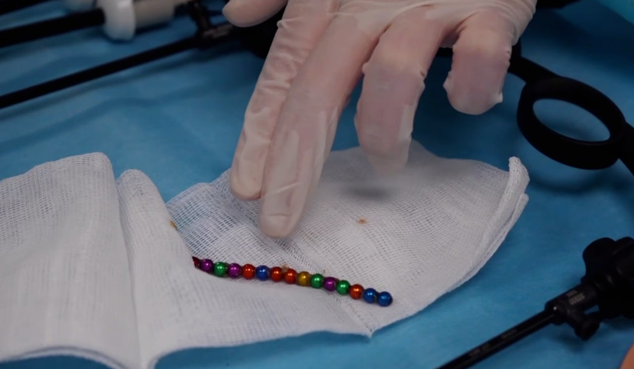 Фото Известный в Бурятии Доктор Юра извлек магниты из кишки годовалой девочки 