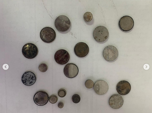 Фото В Бурятии дети проглатывают монеты, магниты и батарейки