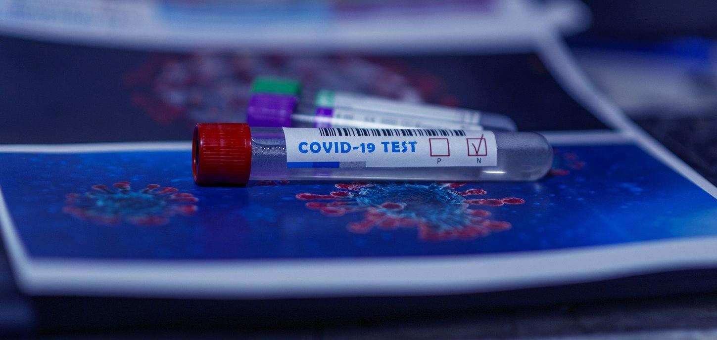 Фото В правительстве опровергли запрет на тесты на COVID-19 в частных клиниках