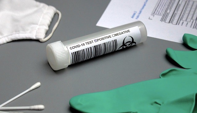 Фото В России впервые в мире зарегистрировали тест на выявление «британского» штамма коронавируса