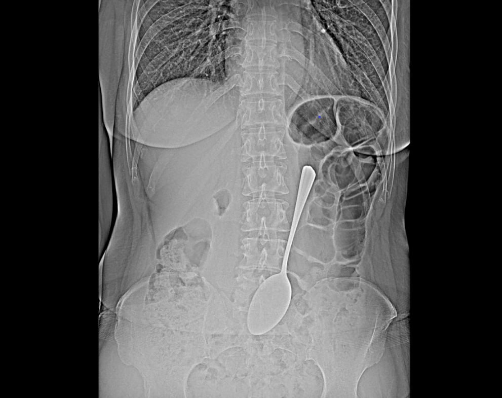 Фото Женщина – факир в Бурятии покинула палаты больницы без единого слова 