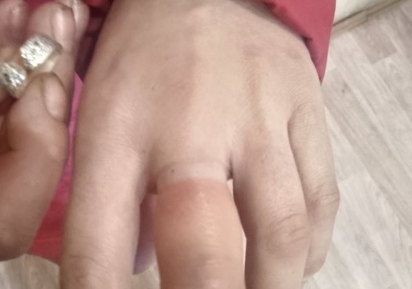 Фото В Бурятии пожарные помогли женщине снять кольцо с пальца