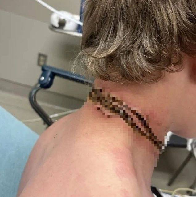 Фото В Бурятии ребенок получил ожоги от телефона на зарядке