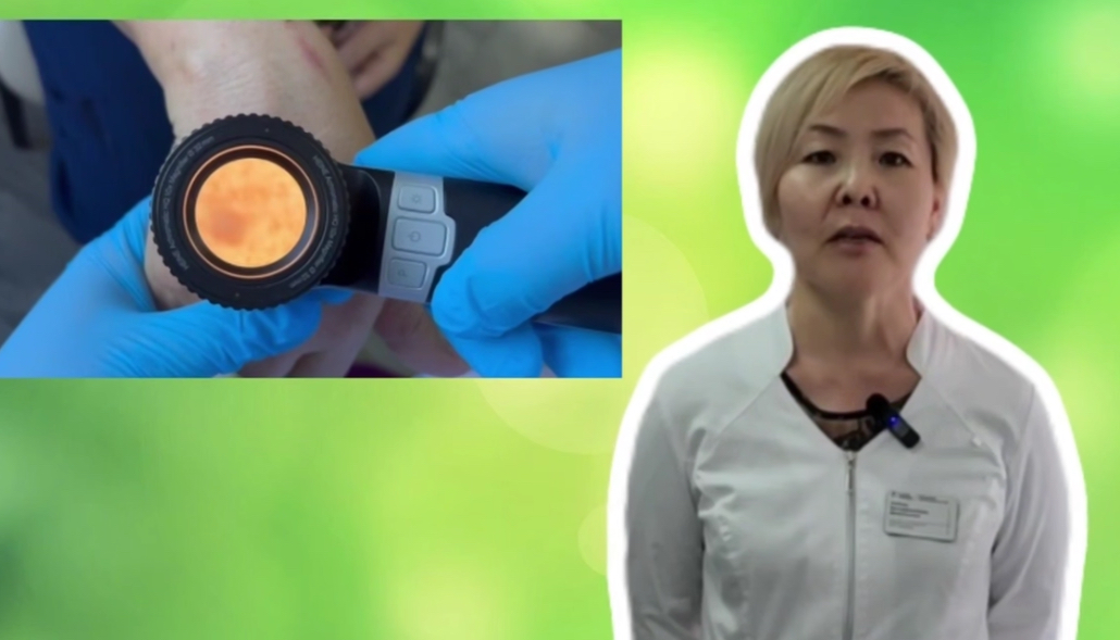 Фото Жителей Бурятии приглашают бесплатно проверить родинки