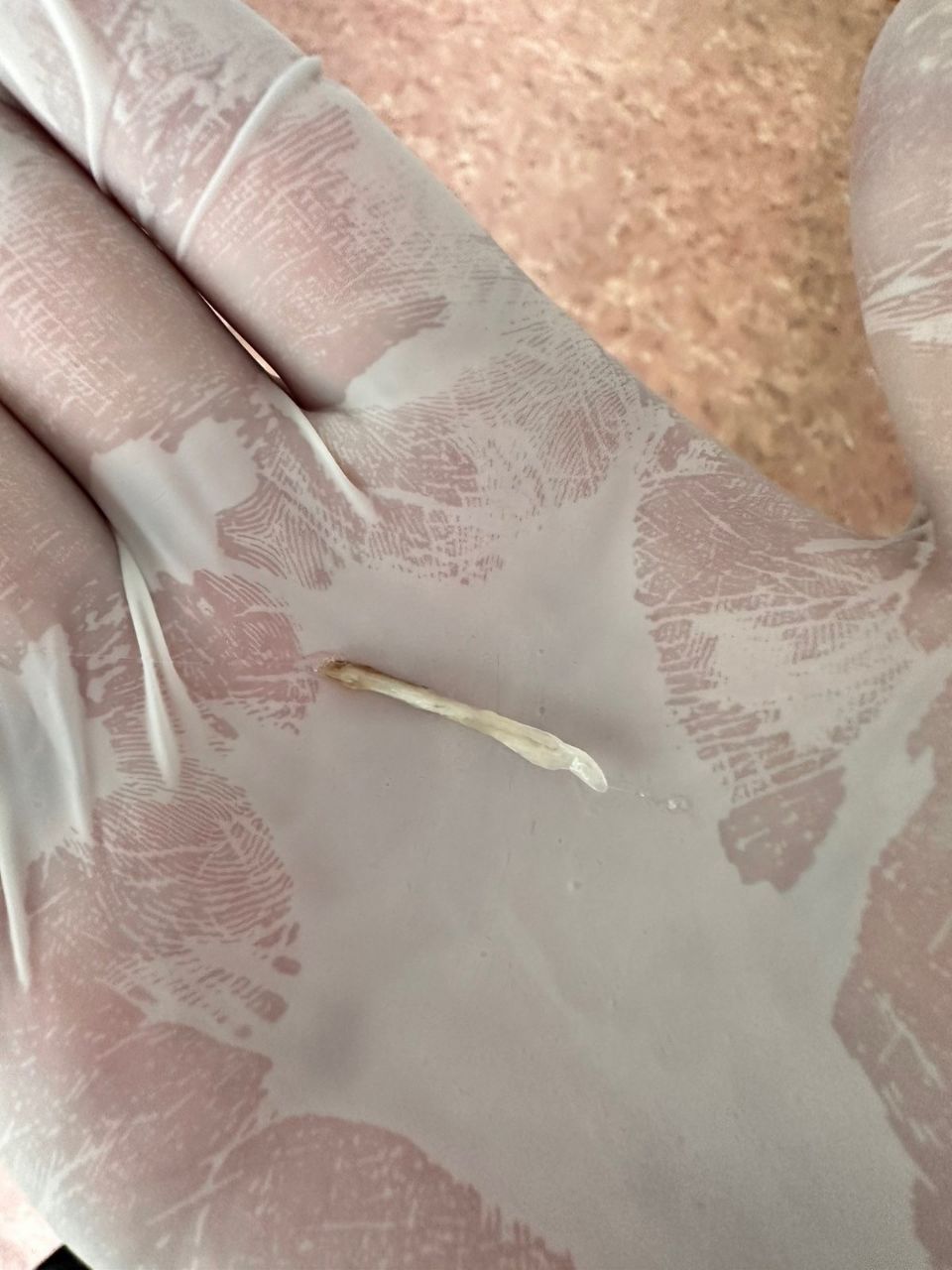 Фото В Бурятии врач извлек из горла женщины рыбную кость