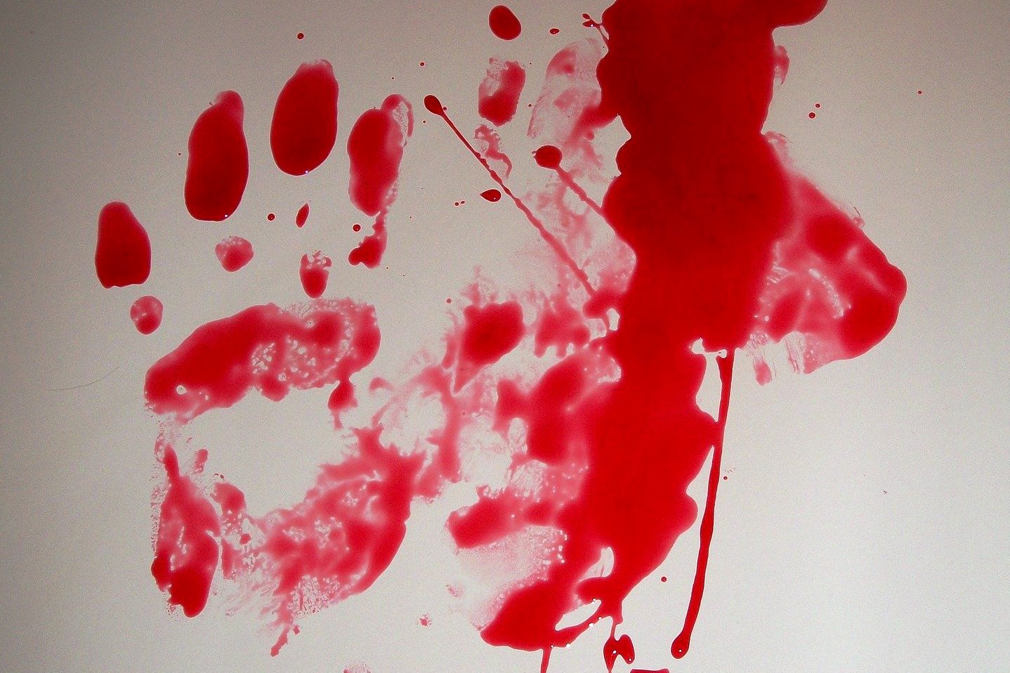 Фото «Кровавый Валентин»: житель Бурятии изувечил молотком семейную пару