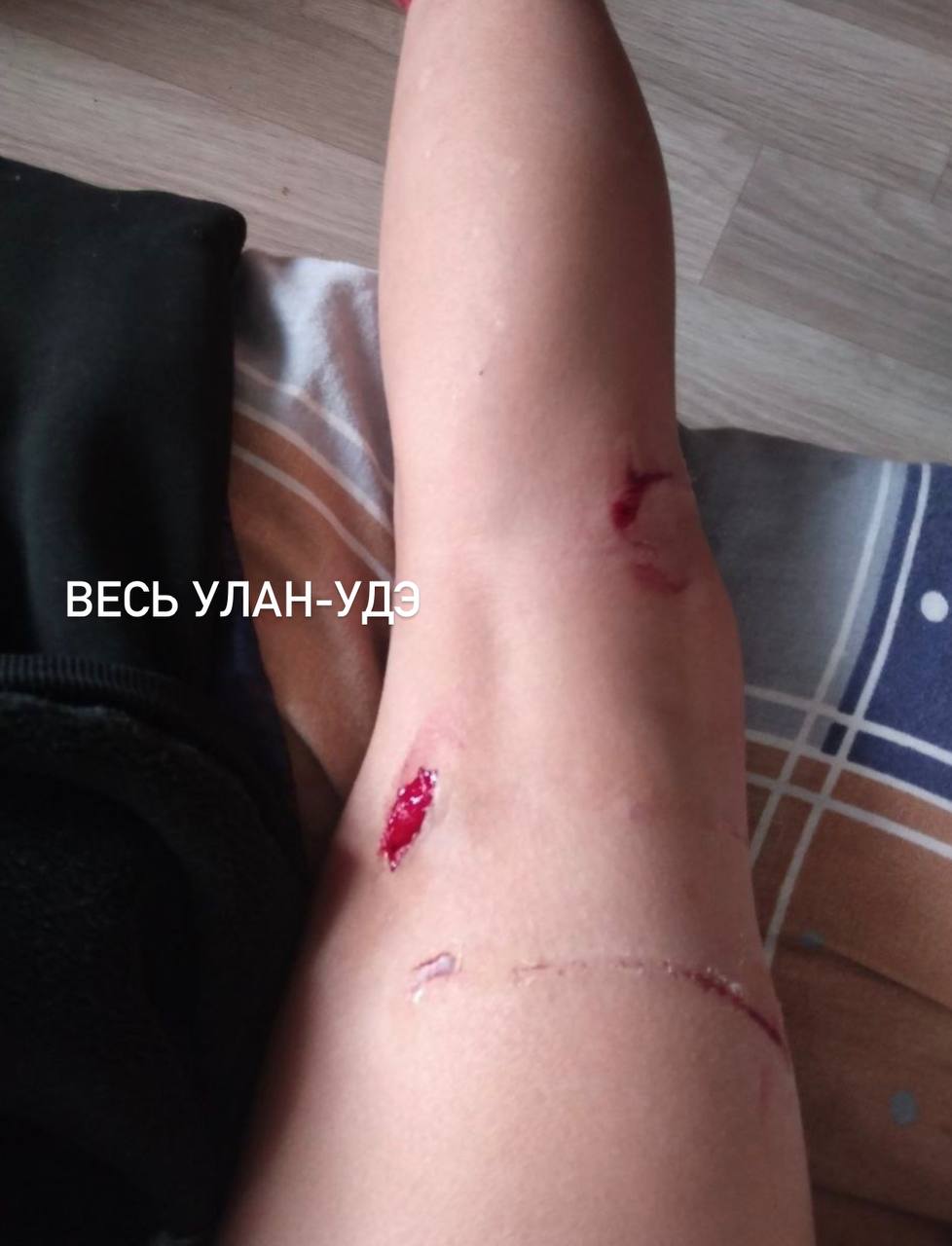 Фото В Бурятии на 11-летнюю девочку напала стая собак